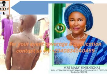 Taraba State Government Condemns Brutal Treatment of Child by Local Teacher