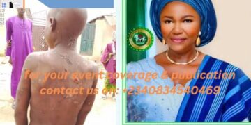 Taraba State Government Condemns Brutal Treatment of Child by Local Teacher